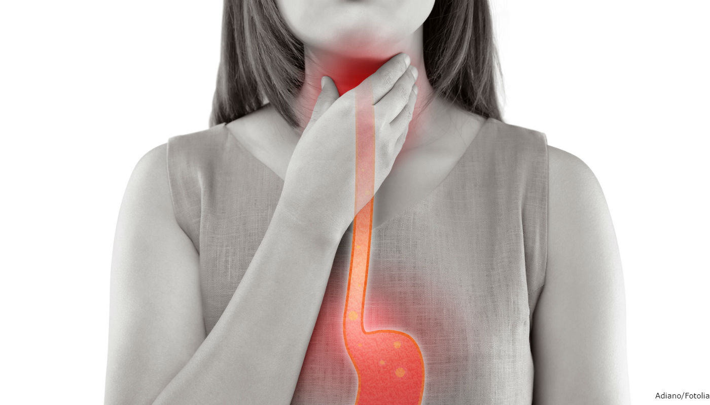 Homeopatia para refluxo: entenda porque o tratamento é eficaz